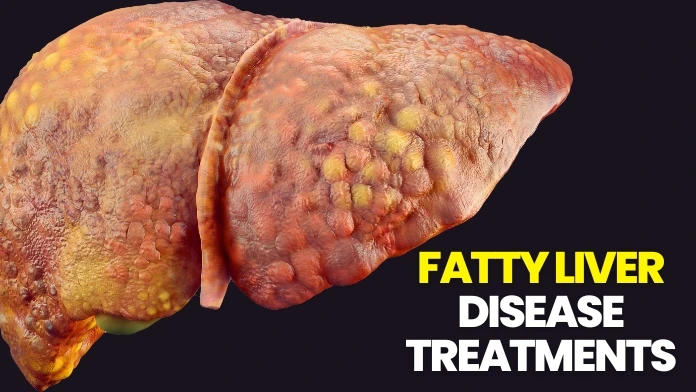 fatty liver disease treatments