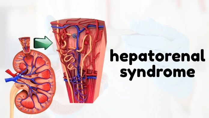 hepatorenal syndrome