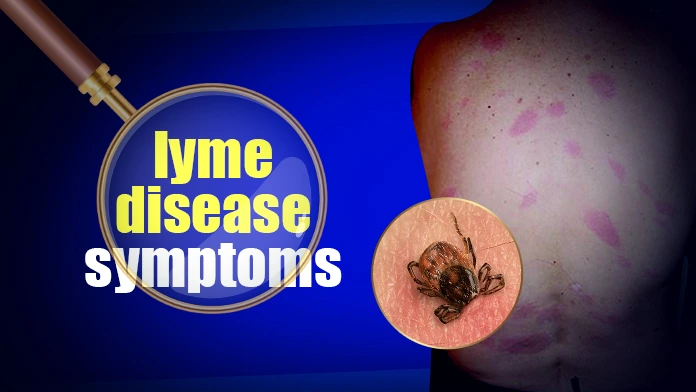 lyme disease symptoms